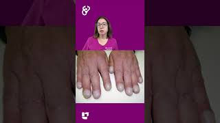 Nail Clubbing: Health Assessment SHORT | @LevelUpRN