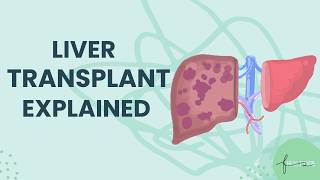 Understanding Liver Transplant Surgery | Evaluation, Waitlist & Recovery