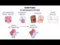 Ankylosing spondylitis (Year of the Zebra 2024)