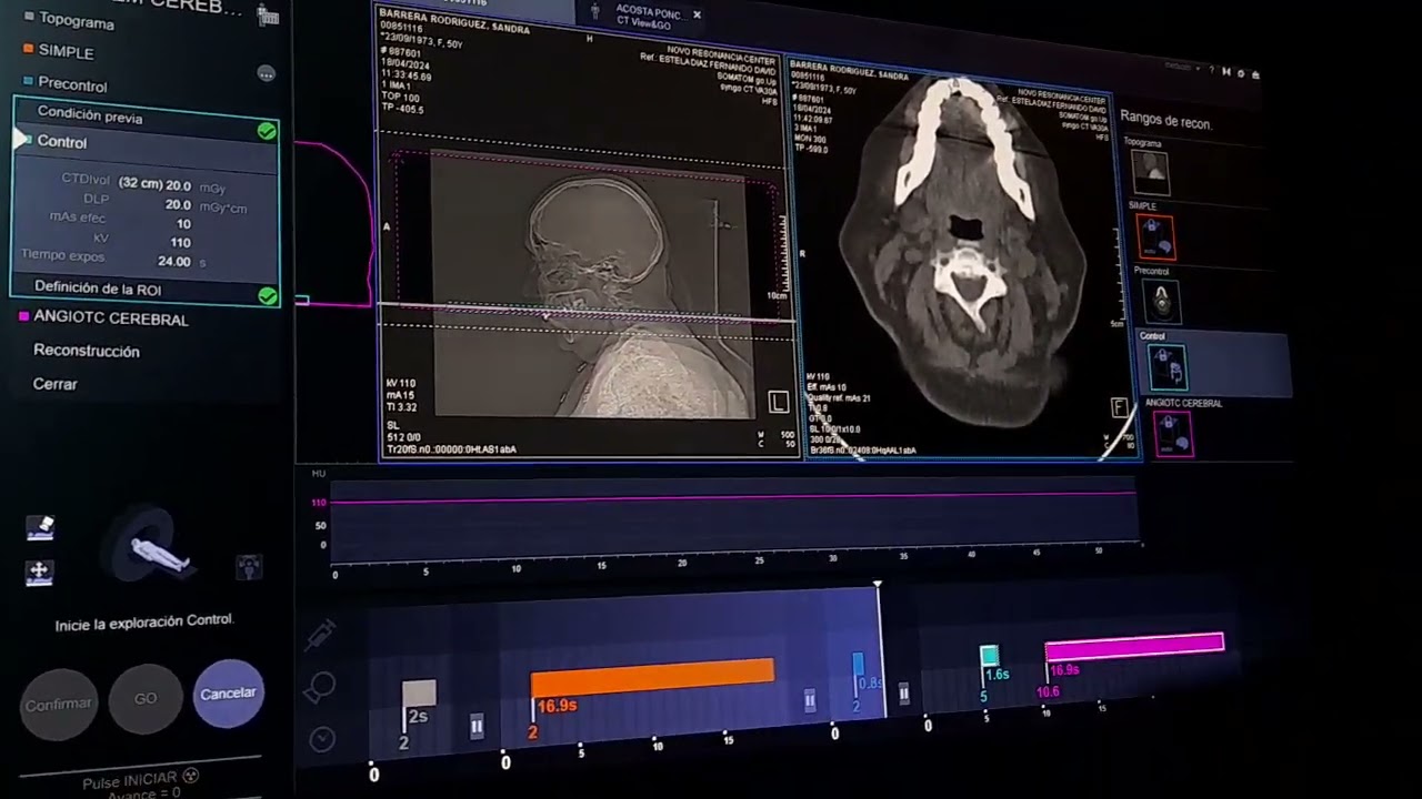 Angiotem Cerebral / Angiotomografia de  Cerebro equipo Siemens  de 64 cortes