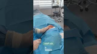 عملية شفط و شد اللغلوغ بإستخدام جهاز الفيزر.الفيزر  كويتيات beforeandafter شفط_اللغلوغ