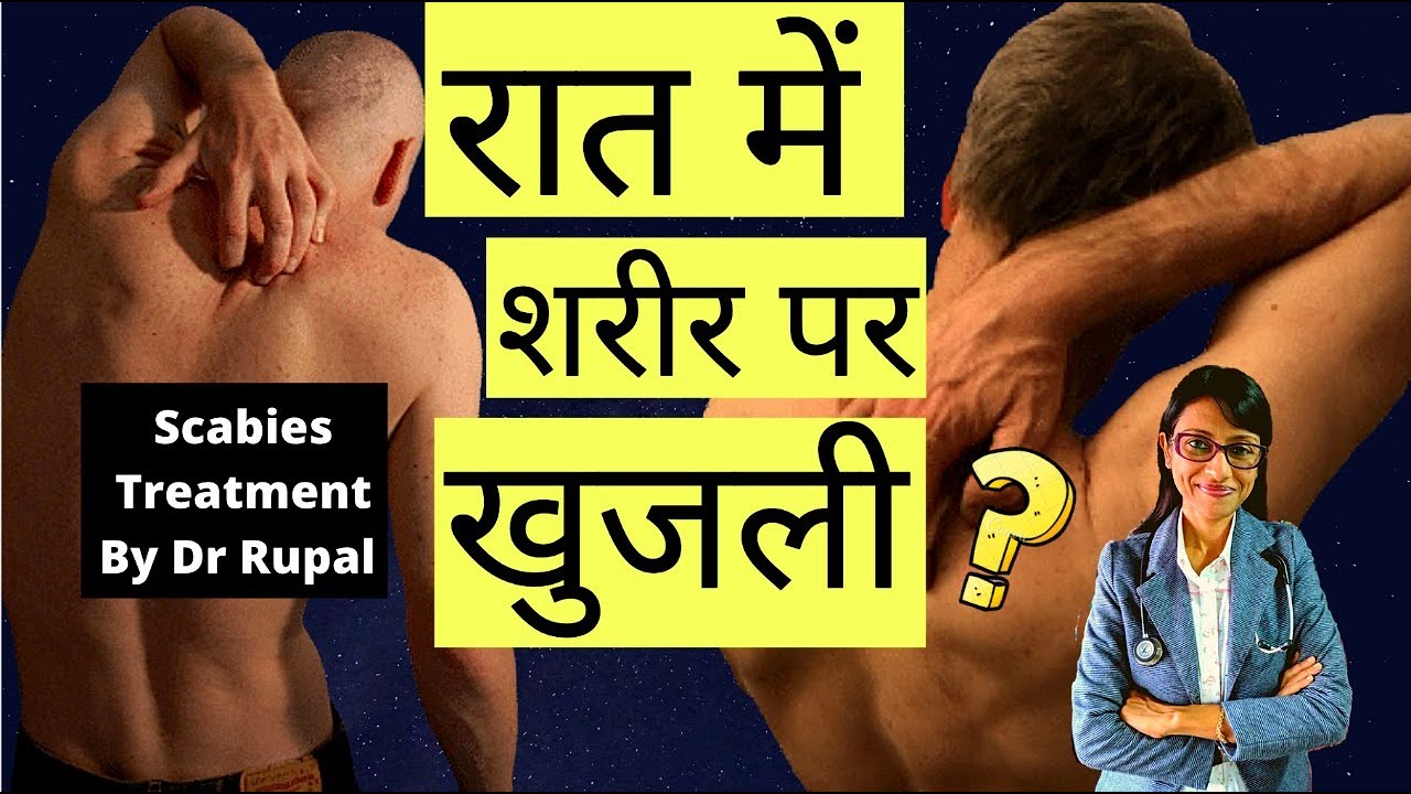 Itching at Night 🙄? Scabies ? Raat ko पूरे Body par खुजली hoti hai