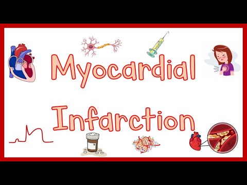 Video: Welke symptomen worden verwacht bij een patiënt die lijdt aan een acuut myocardinfarct?