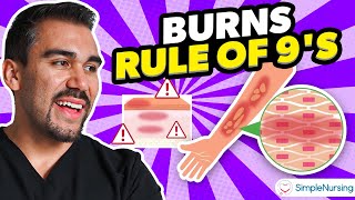 Burns Nursing Overview Rule Of Nines Types Causes Care