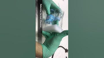 How to Check Cervical Dilation