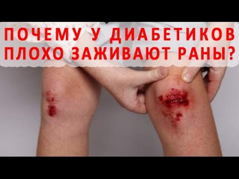 Почему при сахарном диабете плохо заживают раны на коже?