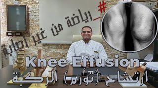 حل تورم (ارتشاح ) الركبه بعد العمليات او الاصابات الرياضيه_Solution to knee effusion
