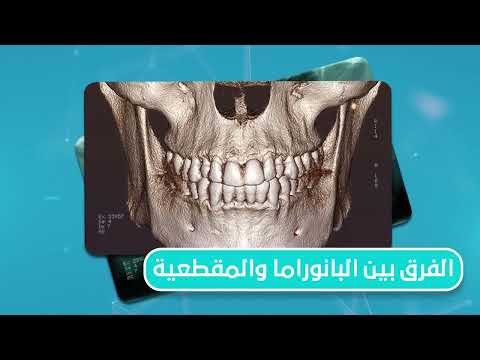     الفرق بين أشعة البانوراما و الأشعة المقطعية للأسنان