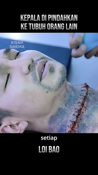 This Man Dared to Transplant His Head onto Another Body! 😱🧠 #movierecap #shorts