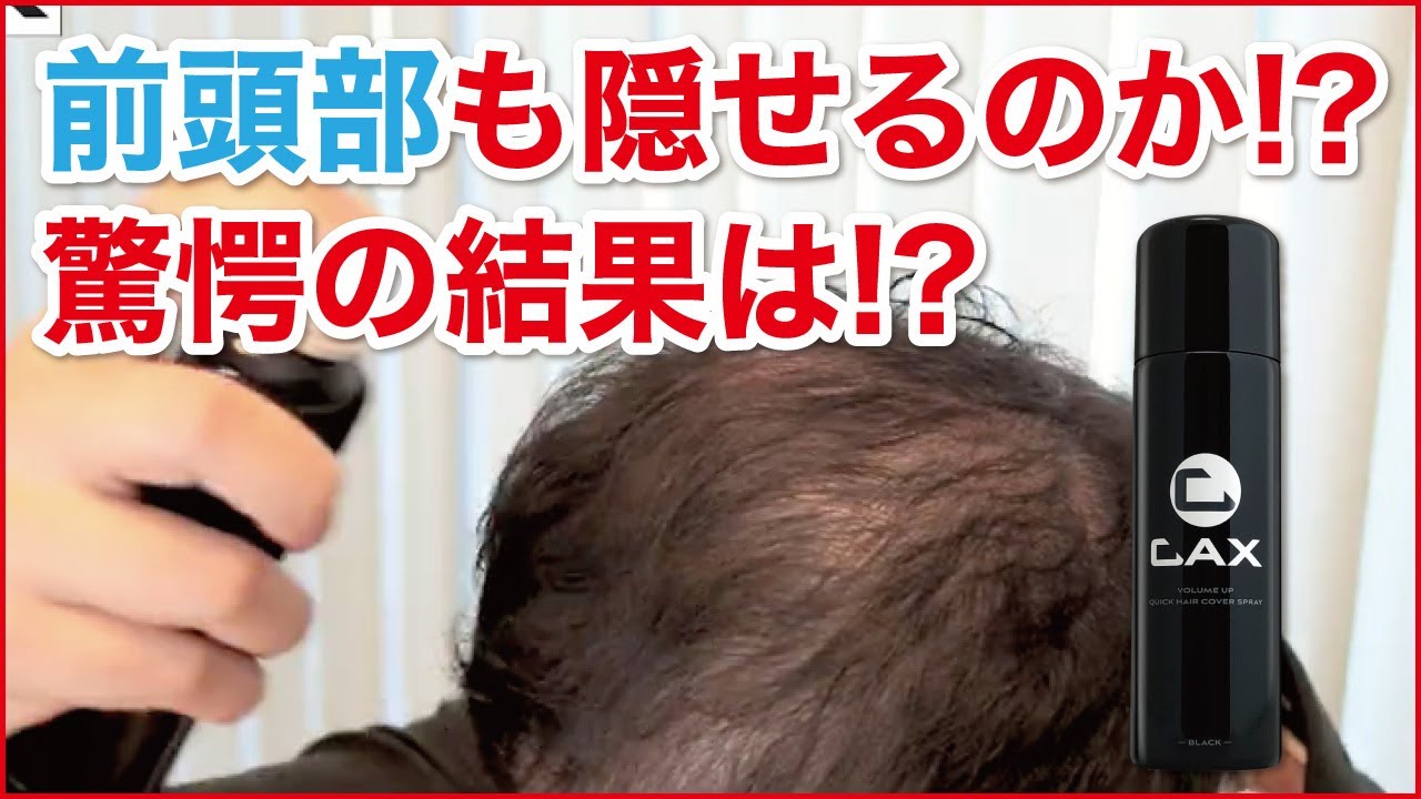 CAX カックス 薄毛隠し用 ヘアスプレー 100gブラック2本セット CAXスプレー100gブラック2本セット CAX カックス ヘアスプレー 100g