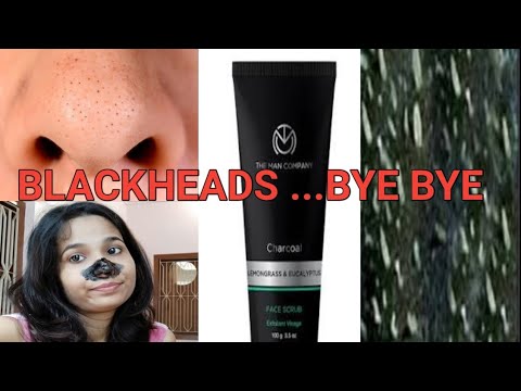HOW TO REMOVE BLACKHEADS AND WHITEHEADS / SAY BYE TO BLACKHEADS