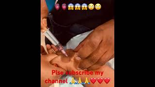 Very Old Age Female Pts Right Radial Abgarterial Blood Gas Blood Sample Collect