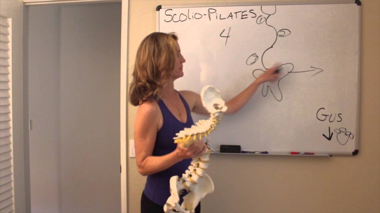 Scoliosis Pilates
