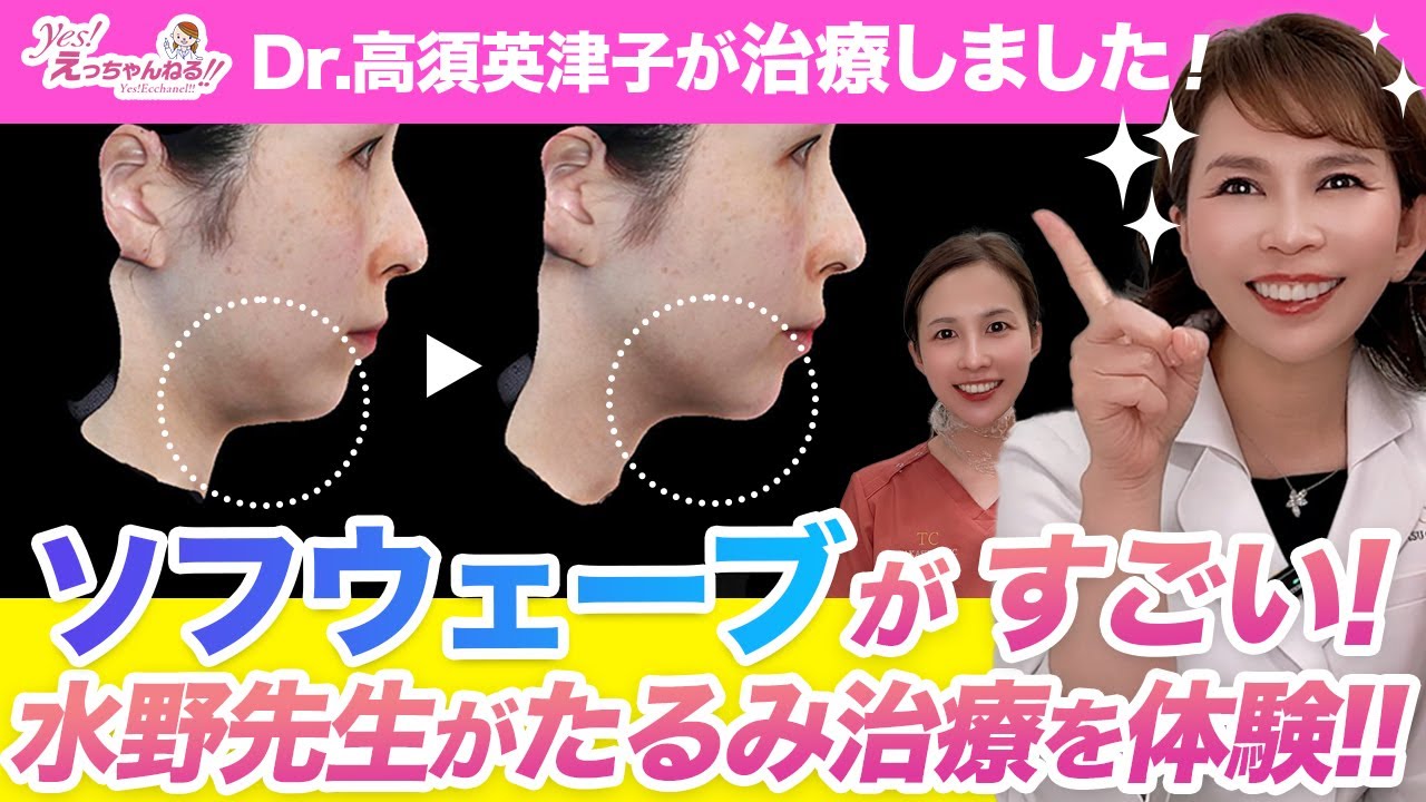 高須クリニック水野玲子先生がソフウェーブを体験しました！【顔のたるみ治療】