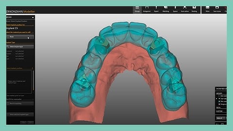 Zirkonzahn CAD/CAM Software-Module Bars