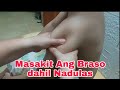 Masakit Ang Braso Pagkatapos Madulas