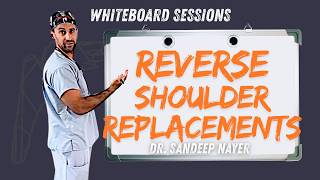 Reverse Shoulder Replacements Explained