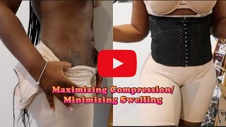 My BBL Journey: How To Maximize Compression And Minimize Swelling After BBL Surgery | angeliejb