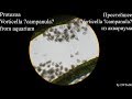 Life in a drop of water from a puddle. Episode 037b - Protozoa Vorticella ?campanula? from aquarium