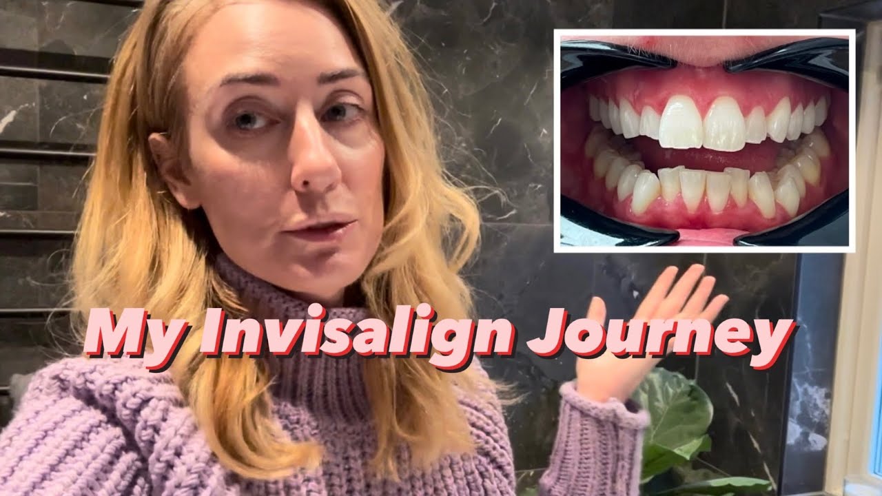 Invisalign - från start till mål! - YouTube