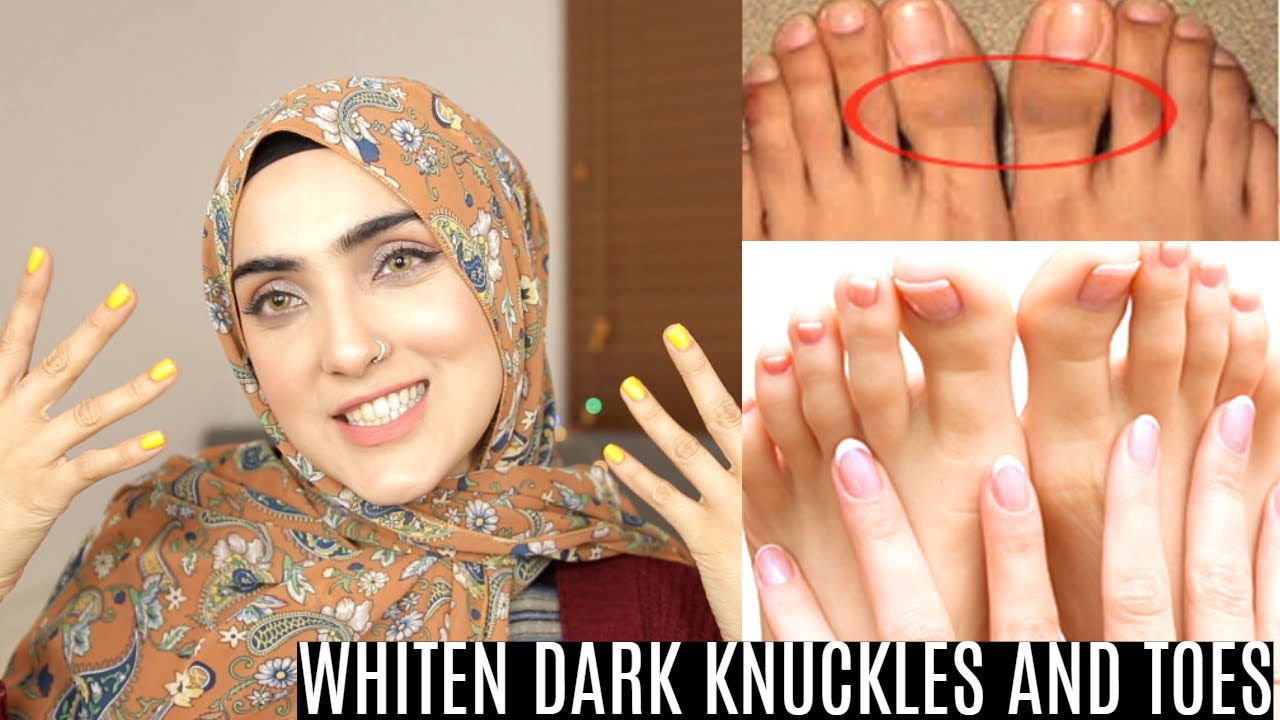 HOW TO BRIGHTEN HANDS+FEET AND LIGHTEN KNUCKLES+TOES (IN URDU STEP BY
