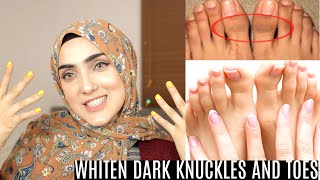 HOW TO BRIGHTEN HANDS+FEET AND LIGHTEN KNUCKLES+TOES (IN URDU STEP BY STEP ROUTINE)~ Immy