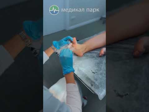 Как происходит удаление