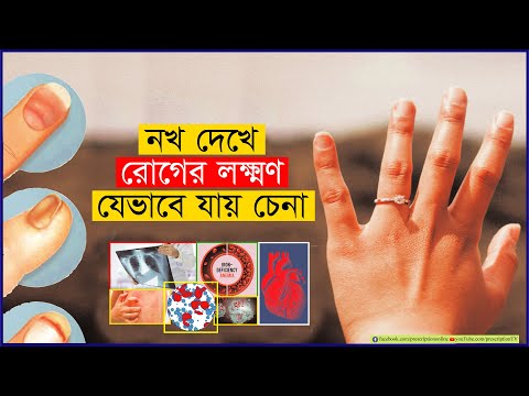 ভিডিও: আঙ্গুলের নখ বিবর্ণ হওয়ার কারণ কী?