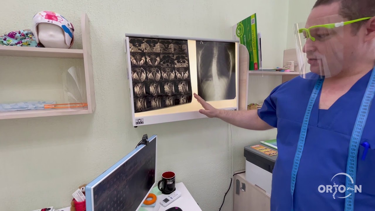 Храните рентгеновские снимки правильно!