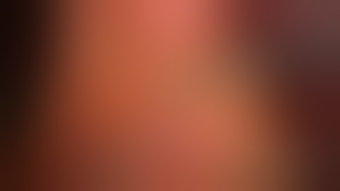 Laparoscopic D2+ total gastrectomy