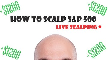 +$1237.50 LIVE DAY TRADING $500 SCALPING Only 1 Price Action Setup | Two Legged Pullback  ep19