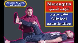 meningitis "clinical examination" I الفحص السريري لالتهاب السحايا