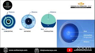Managing Presbyopia with Contact lens Learn from the Masters - Sankara Academy of Vision screenshot 5