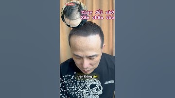 Xâm chân tóc, thay đổi nhỏ, hiệu quả tuyệt vời #reviewxămtóc #vnscalp