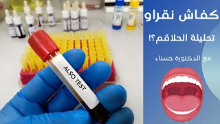 كفاش نقراو تحليلة الحلاقم ASLO مع الدكتورة حسناء