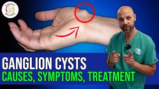 Ganglion Cysts | Causes | Symptoms | Treatments screenshot 4