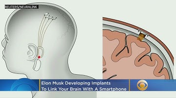 Elon Musk Is Making Implants To Link The Brain With A Smartphone