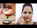 झुर्रियों से बचाव और ईलाज || Treatment of Wrinkles & Fine Lines (In Hindi)