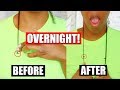 GROW NATURAL HAIR OVERNIGHT😱🙌🏾 // 1INCH IN 12HRS **NOT CLICKBAIT**