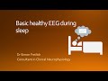 Sleep architecture on the EEG