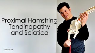 Proximal Hamstring Tendinopathy and Sciatica | Episode 58