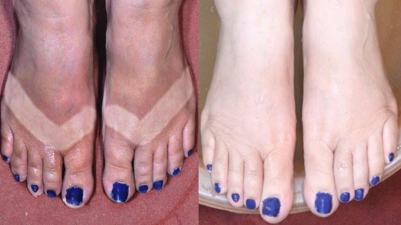Feet Whitening Pedicure At Home How To Remove Sun Tan Skin Whitening Remedy Youtube remove sun tan skin whitening remedy