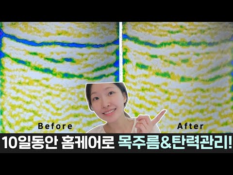 <strong>cc</strong>)10일동안 홈케어로 목주름&amp;<strong>amp</strong>;탄력 관리하기!!진짜 믿을수없는결과....👀ㅣ아랑