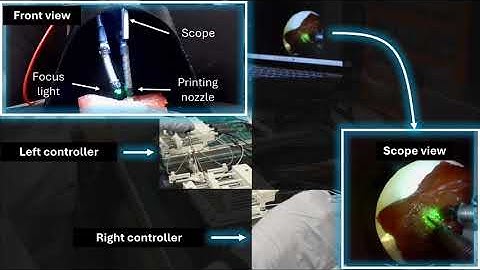 Motor-Free Soft Robots for Cancer Detection, Surgery, and In Situ Bioprinting Video 4