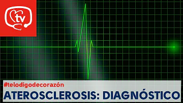 ¿Cuál es la mejor prueba para detectar la aterosclerosis?