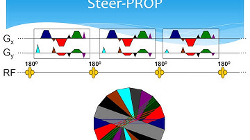 Girish Srinivasan: Steer-PROP, a GRASE-PROPELLER Sequence With Interecho Steering Gradient Pulses