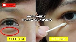 Cukup 5 Menit Kantung Mata Hilang Selamanya - Durasi: 4.10. 