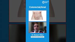 🎥 Colorectal & Anal MCQs Discussion by Dr. Rakesh Mittal
