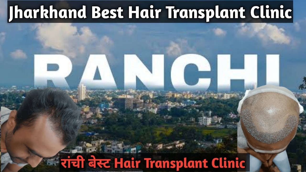 Ranchi Best Hair Transplant Clinic Jharkhand Hair Transplant Clinic