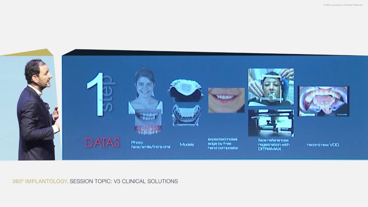 V3 Implant: A Versatile Implant for Functional and Aesthetic Rehabilitation